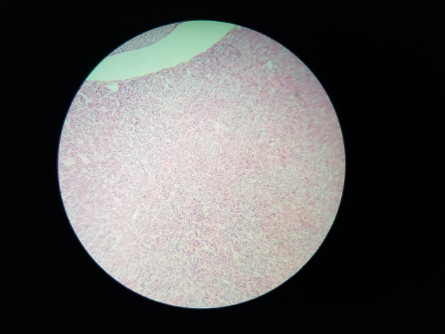 Pituitary Gland Slides - Pituitary Gland 012 400X